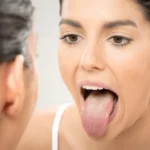 Lengua blanquecina y pastosa: causas, síntomas y tratamientos