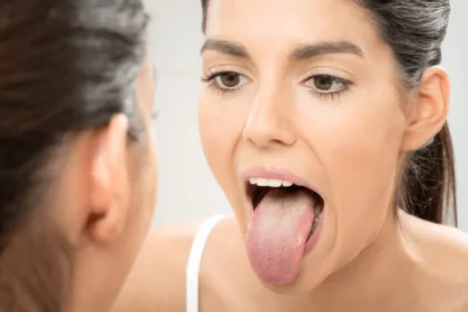 Lengua blanquecina y pastosa: causas, síntomas y tratamientos