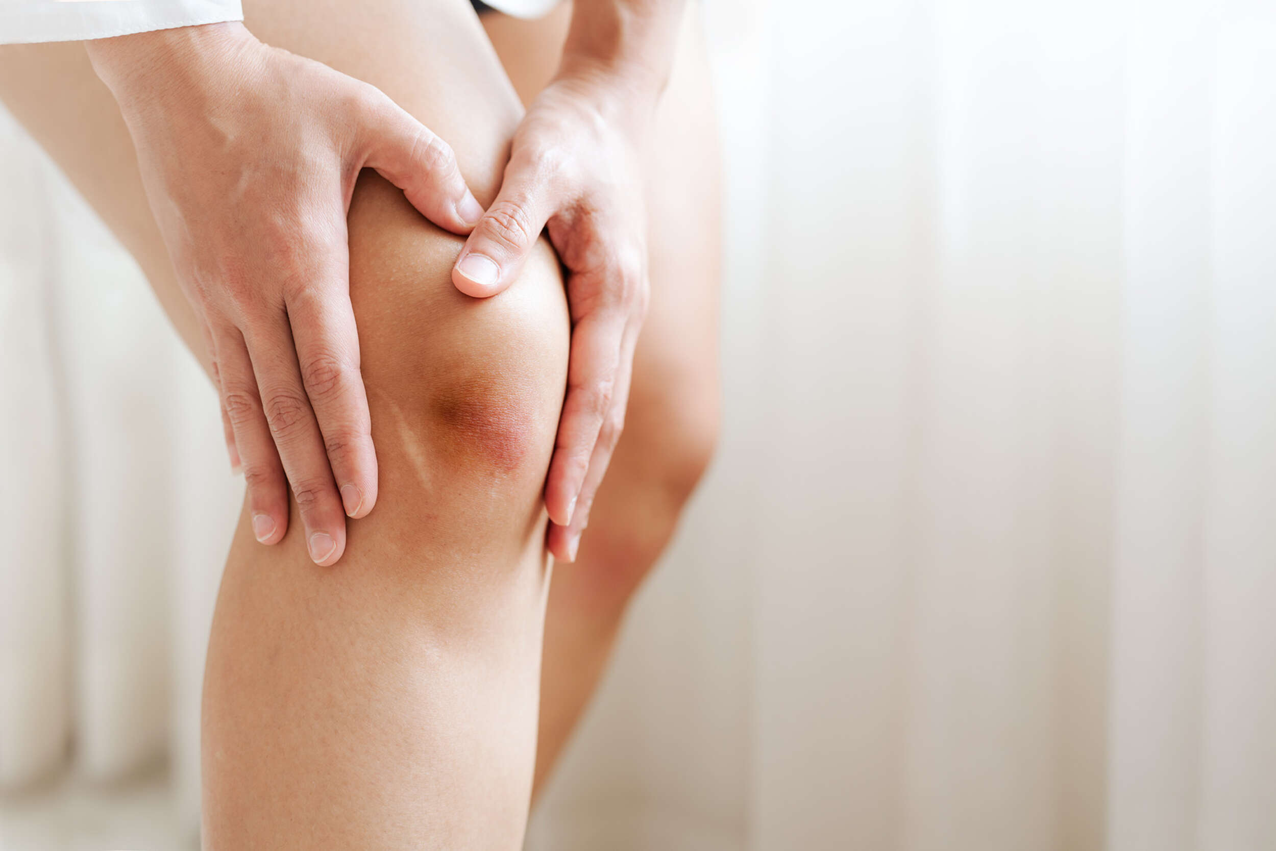  Qué Es Bueno Para Los Golpes? Tips and remedies to relieve bumps and bruises