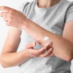 Hongos En La Piel Manchas: A Complete Guide to Recognizing, Treating, and Preventing