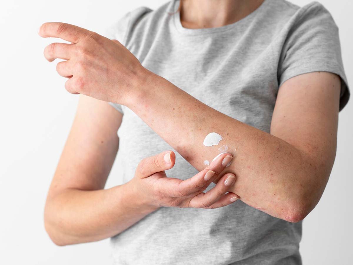 Hongos En La Piel Manchas: A Complete Guide to Recognizing, Treating, and Preventing