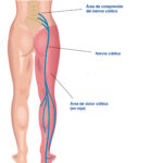 El Quiropráctico Para Qué Sirve y Cómo Puede Beneficiar Tu Salud?