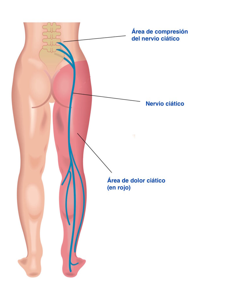 El Quiropráctico Para Qué Sirve y Cómo Puede Beneficiar Tu Salud?